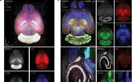 RNA analysis of the whole brain