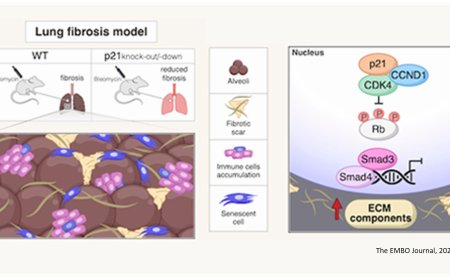 How p21 promotes pulmonary fibrosis?