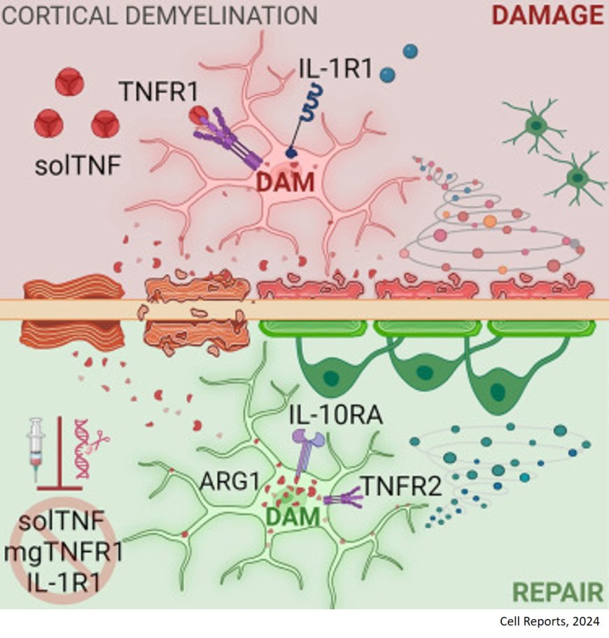 Microglia regulate cortical remyelination via TNFR1- dependent phenotypic polarization