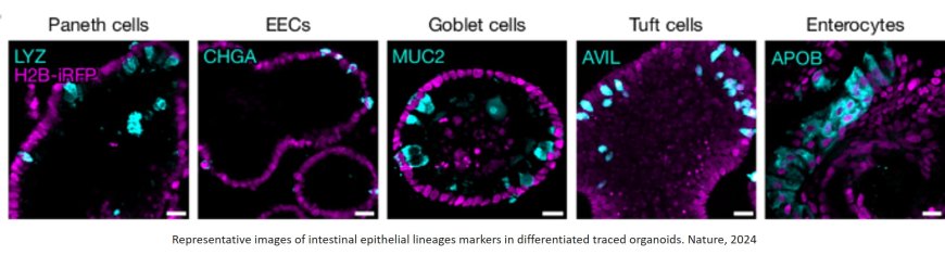 Tuft cells act as regenerative stem cells in the human intestine