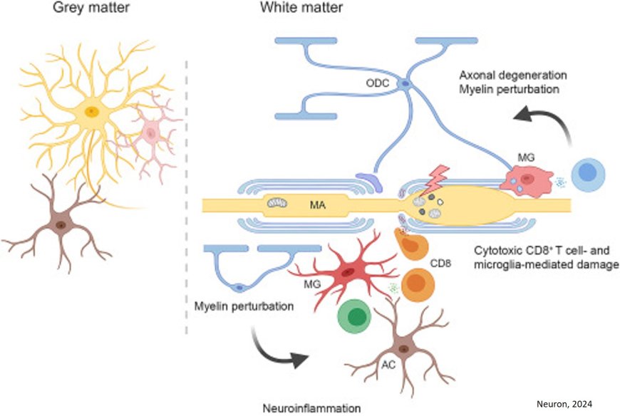 White matter aging and its impact on brain function