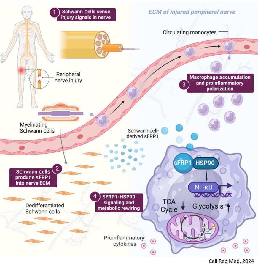 Schwann cell-secreted frizzled-related protein 1 dictates neuroinflammation and peripheral nerve degeneration after neurotrauma