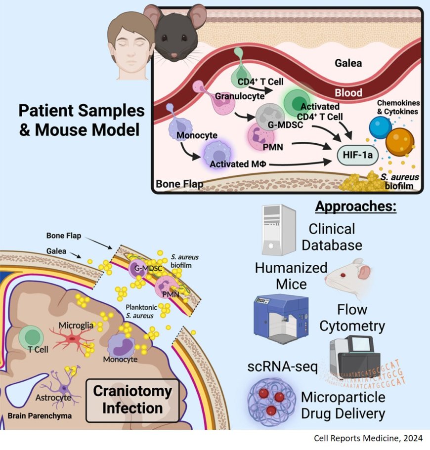 Single-cell profiling reveals a conserved role for hypoxia-inducible factor signaling during human craniotomy infection