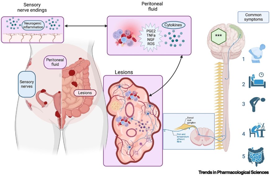 Cannabidiol therapy for symptom relief in endometriosis