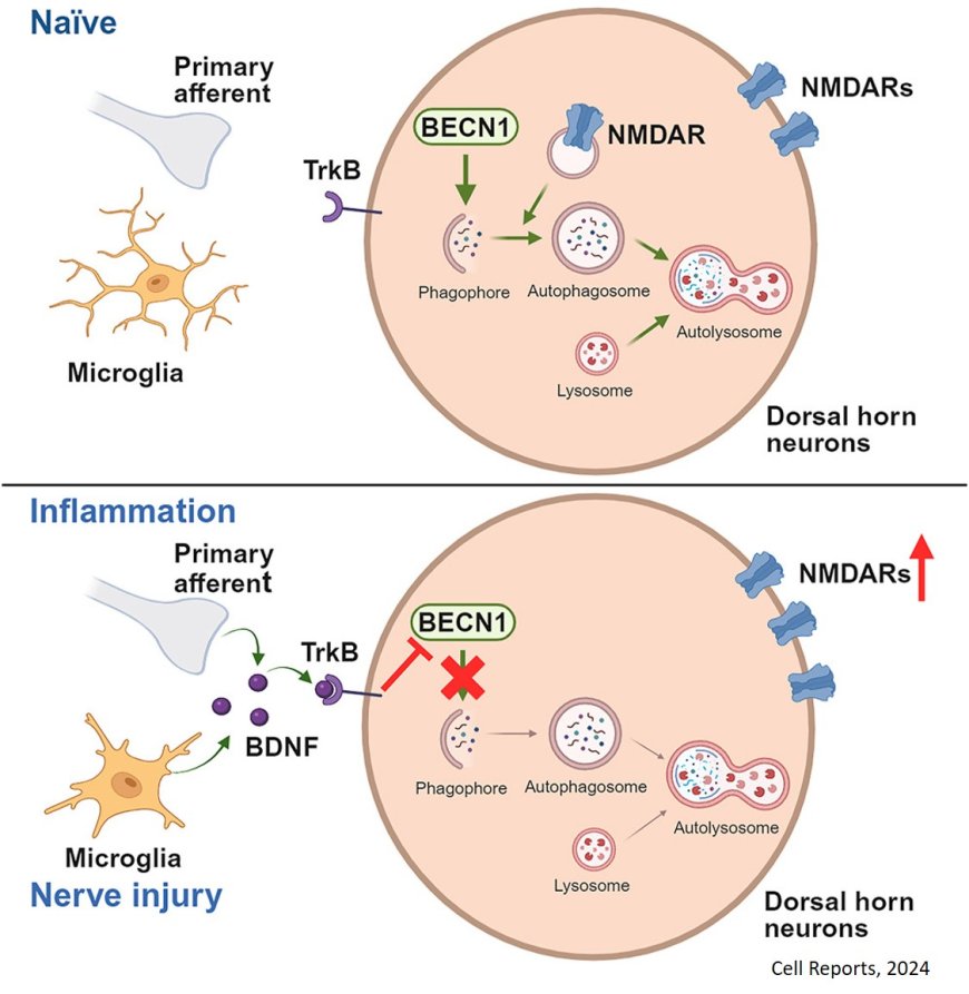 Pain hypersensitivity is dependent on autophagy protein Beclin 1 in males but not females