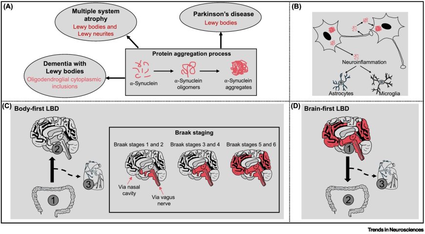 The intertwined relationship between circadian dysfunction and Parkinson's disease