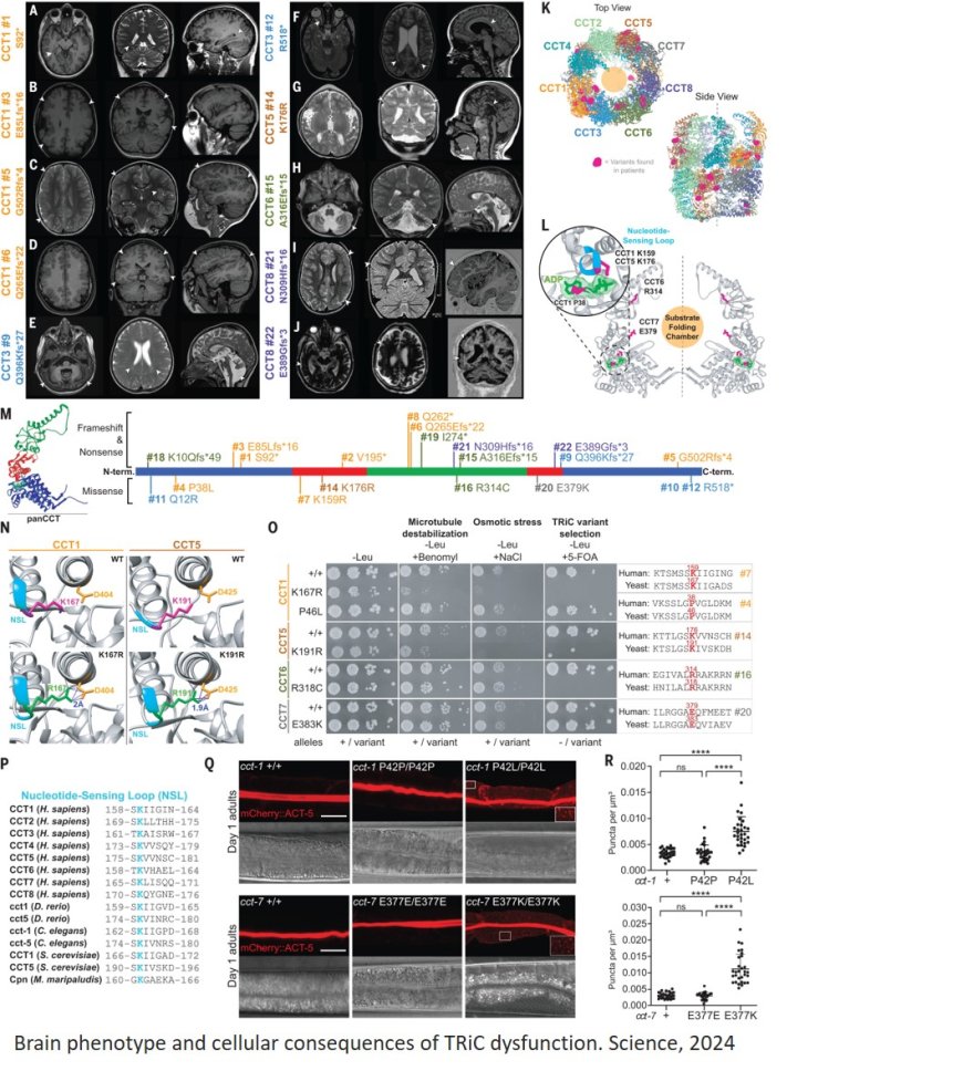 Impaired chaperonin function may cause brain malformations and seizures