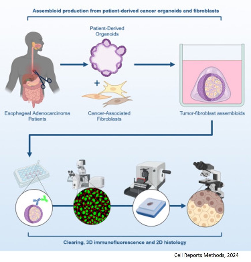 Patient-derived tumor organoid and fibroblast assembloid models for interrogation of the tumor microenvironment in esophageal adenocarcinoma