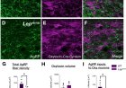 Leptin in neurodevelopment!