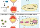 Nanoparticle-based itaconate treatment for atherosclerotic plaque resolution