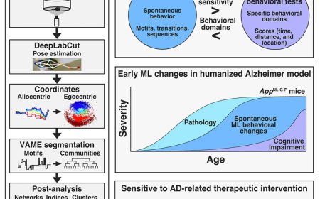 AI detects behaviors linked with early Alzheimer’s
