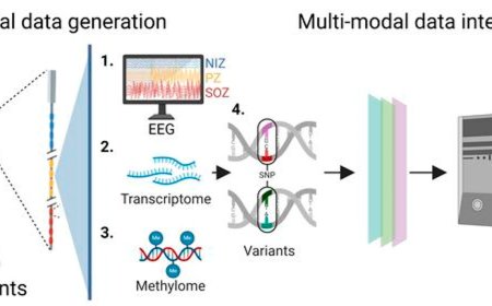 Combining genetics and brain mapping to treat epilepsy