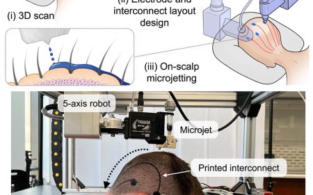 On-scalp printing of personalized electroencephalography e-tattoos