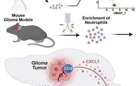 Role of neutrophils in glioma progression
