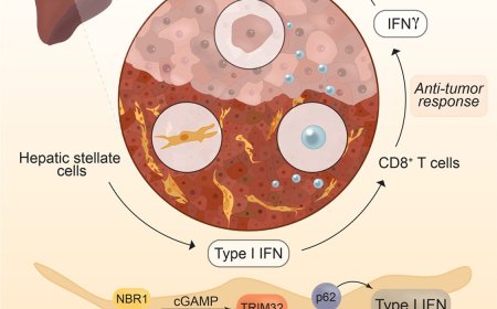 Mechanism of progression of hepatocellular carcinoma