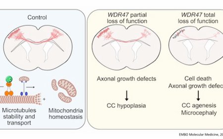 Bi-allelic variants in WDR47 cause a complex neurodevelopmental syndrome