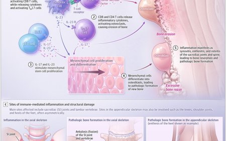 Axial Spondyloarthritis