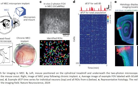 “Time cells” in the brain are critical for complex learning