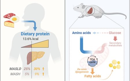 Amino acid is a major carbon source for hepatic lipogenesis