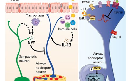 Airway sensory neuronal reprogramming by cytokines in asthma