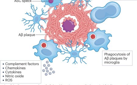 Neuroinflammation in Alzheimer disease