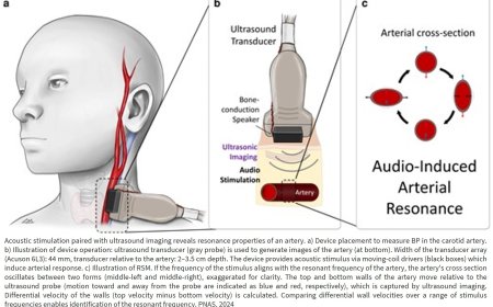 First noninvasive method to continually measure true blood pressure