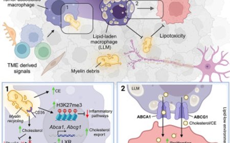 Brain cancer malignancy fueled by myelin recycling in macrophages