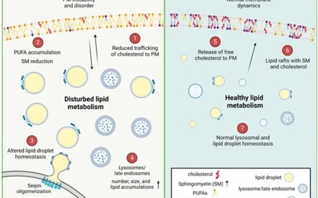 Human Schwann cell lipid dysregulation and plasma membrane perturbation in Charcot–Marie–Tooth disease type 1A disease