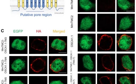 Human TMC1 and TMC2 are mechanically gated ion channels