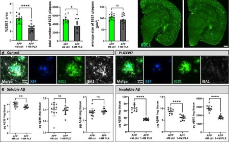 Varying roles of microglia in Alzheimer’s disease