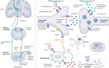 Central neuropathic pain