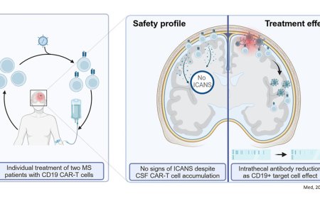 CAR-T cells for multiple sclerosis