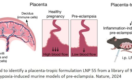 A lipid nanoparticle delivers mRNA cure for pre-eclampsia