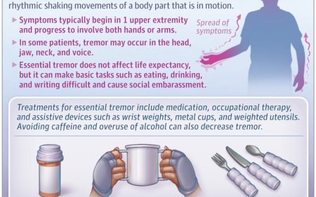 What Is Essential Tremor?