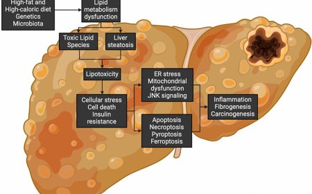Lipotoxicity-driven metabolic dysfunction-associated steatotic liver disease (MASLD)