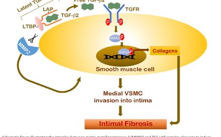 A new mechanism for type 2 diabetes-associated atherosclerosis