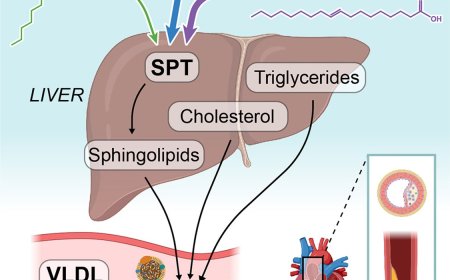 How dietary trans-fat induces atherosclerosis