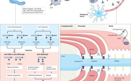 Guillain–Barré syndrome