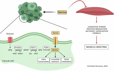 Mechanism of muscle wasting in cancer cachexia