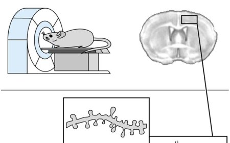 Brain plasticity studies using animal models to humans