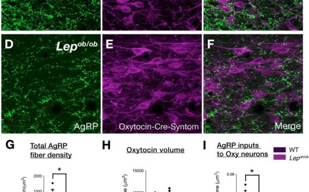 Leptin in neurodevelopment!