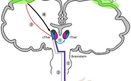 Treating essential tremor (ET) with deep brain stimulation