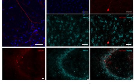 The link between stress, aging and senescent cells