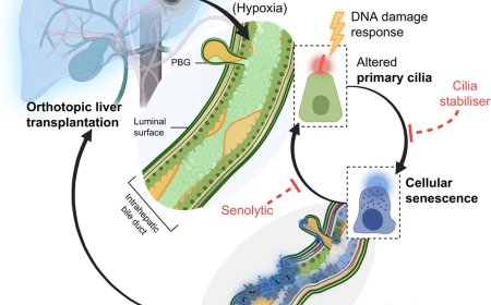 How pre-transplantation ischemia impairs liver regeneration