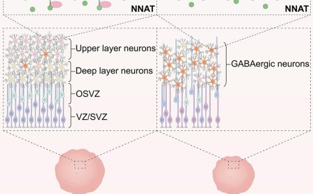 The role of chromodomain protein CDYL in human cortical development