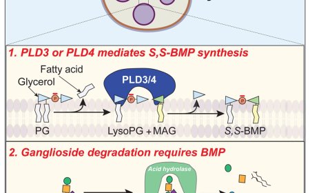 Abnormal lipid degradation in lysosomes of Alzheimer’s brain
