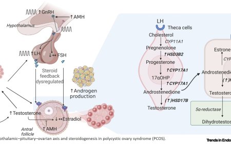Polycystic ovary syndrome (PCOS) inheritance!