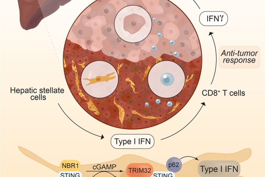 Mechanism Of Progression Of Hepatocellular Carcinoma Sciencemission