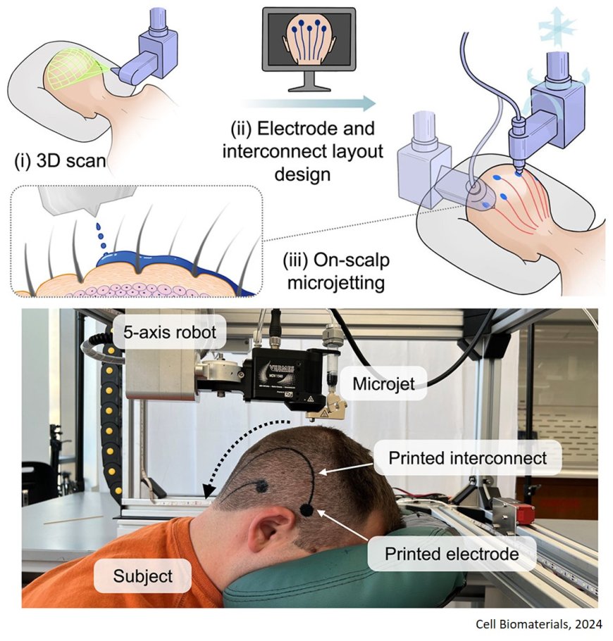 On-scalp printing of personalized electroencephalography e-tattoos