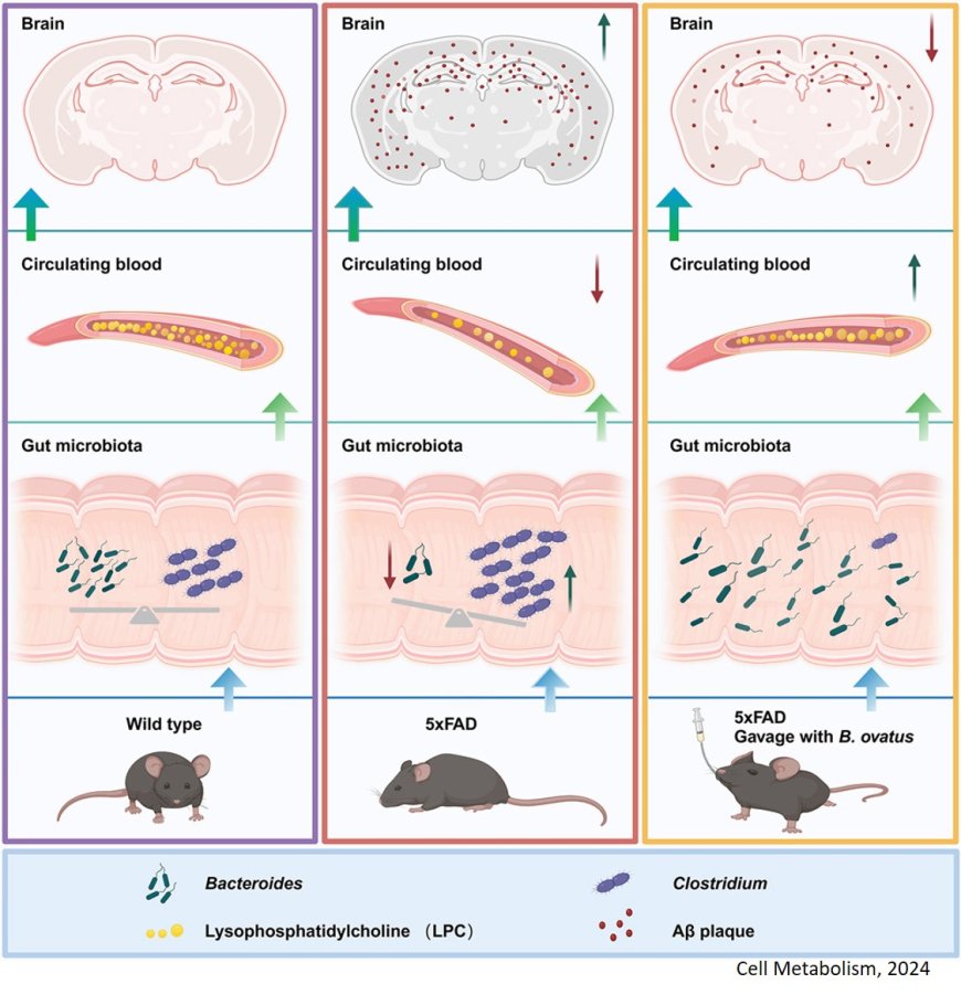 Microbiota-derived lysophosphatidylcholine alleviates Alzheimer’s disease pathology via suppressing ferroptosis